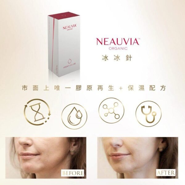 [正貨保證] Neauvia冰冰針(2x2.5ml/box 2支裝) 家用微針/導入 美容院貨源